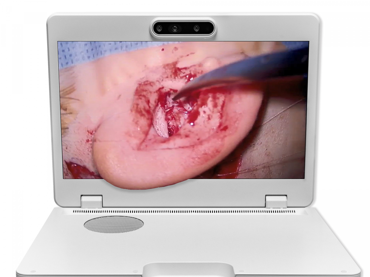 达擎之＂Heads-up 3D显微手术显示系统＂，整合4K裸眼3D显示及眼球追踪系统，具备快速追踪人眼移动位置功能，减轻医师长时间维持固定姿势的负担，让医师能有更宽广清晰的3D立体视野及更舒适的姿势来执行手术。